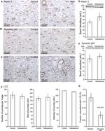 Ataxin 3 Antibody in Immunohistochemistry (IHC)