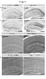 ADAMTS4 Antibody in Immunohistochemistry (IHC)