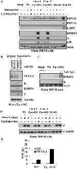 Epstein Barr Virus p18 Antibody in Western Blot (WB)