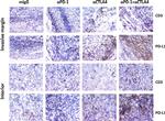 CD274 (PD-L1, B7-H1) Antibody in Immunohistochemistry (IHC)