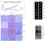 VEGF Receptor 3 Antibody in Immunohistochemistry (IHC)