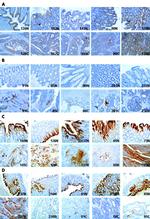 COX2 Antibody in Immunohistochemistry (IHC)