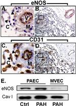 eNOS Antibody in Immunohistochemistry (IHC)