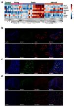 NR5A1 Antibody in Immunohistochemistry (IHC)