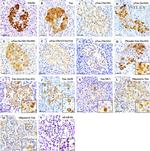 Phospho-Tau (Ser422) Antibody in Immunohistochemistry (IHC)