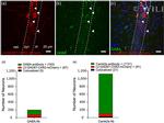 CaMKII alpha Antibody in Immunocytochemistry (ICC/IF)