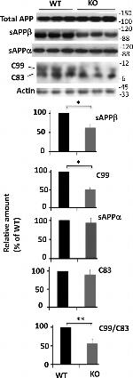 beta Amyloid Antibody in Western Blot (WB)