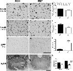 Amyloid Precursor Protein Antibody in Immunohistochemistry (Paraffin) (IHC (P))