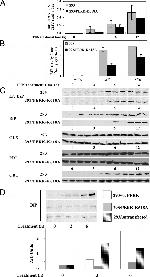 PDI Antibody in Western Blot (WB)