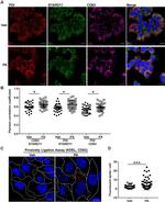 PDI Antibody in Immunocytochemistry (ICC/IF)