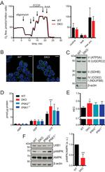 AMPK alpha-1 Antibody in Western Blot (WB)