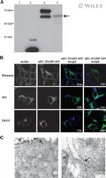 PDI Antibody in Immunocytochemistry (ICC/IF)