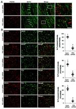 NMDAR2A Antibody in Immunocytochemistry, Immunohistochemistry (ICC/IF, IHC)