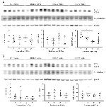 LC3B Antibody in Western Blot (WB)