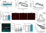 Laminin Antibody in Immunohistochemistry (IHC)