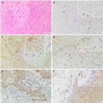 SOX2 Antibody in Immunohistochemistry (IHC)