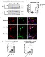 SQSTM1 Antibody in Western Blot, Immunocytochemistry (WB, ICC/IF)