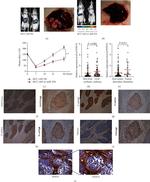 Periostin Antibody in Immunohistochemistry (IHC)