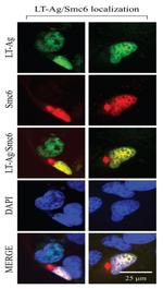 DYKDDDDK Tag Antibody in Immunocytochemistry (ICC/IF)