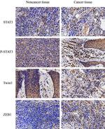 TWIST1 Antibody in Immunohistochemistry (IHC)