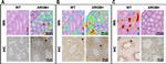 CCT6A Antibody in Immunohistochemistry (Paraffin) (IHC (P))