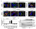 PDI Antibody in Immunocytochemistry (ICC/IF)