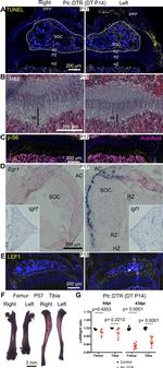 CD90 (Thy-1) Antibody in Immunohistochemistry (IHC)