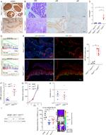 Ki-67 Antibody in Immunohistochemistry (IHC)