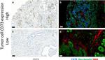 Pan Cytokeratin Antibody in Immunohistochemistry (IHC)