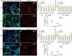 CD138 Antibody in Immunohistochemistry, Immunohistochemistry (Paraffin) (IHC, IHC (P))