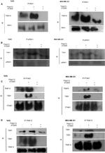 Phospho-IRAK1 (Thr209) Antibody in Western Blot (WB)