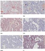 Vitronectin Antibody in Immunohistochemistry (IHC)