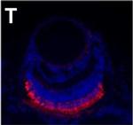 Mouse IgG2a Cross-Adsorbed Secondary Antibody in Immunohistochemistry (IHC)