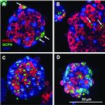 Mouse IgG (H+L) Highly Cross-Adsorbed Secondary Antibody in Immunocytochemistry (ICC/IF)