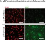 Mouse IgG (H+L) Highly Cross-Adsorbed Secondary Antibody in Immunocytochemistry (ICC/IF)