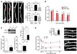 Thrombospondin 1 Antibody