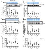 GLUT4 Antibody in Western Blot (WB)