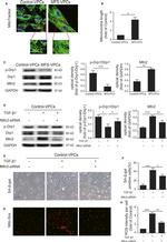 Phospho-DRP1 (Ser616) Antibody