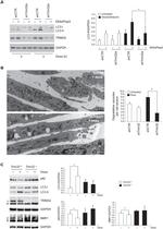 TRIM32 Antibody