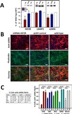 IGF2R Antibody