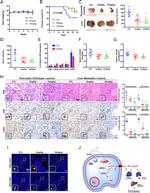 CD4 Antibody in Immunohistochemistry (IHC)