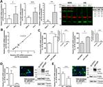 Amyloid Precursor Protein Antibody in Western Blot (WB)