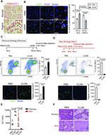 CD68 Antibody in Immunohistochemistry (IHC)