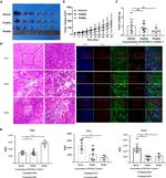 FOXP3 Antibody in Immunohistochemistry (IHC)