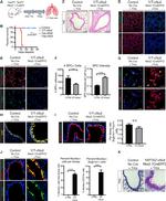 FOXJ1 Antibody in Immunocytochemistry (ICC/IF)