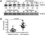 TRIM10 Antibody in Western Blot (WB)