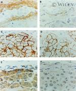 CD44std Antibody in Immunohistochemistry (IHC)