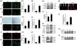 Aggrecan Antibody in Western Blot (WB)