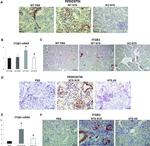 Periostin Antibody in Immunohistochemistry (IHC)