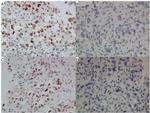 MDM2 Antibody in Immunohistochemistry (IHC)